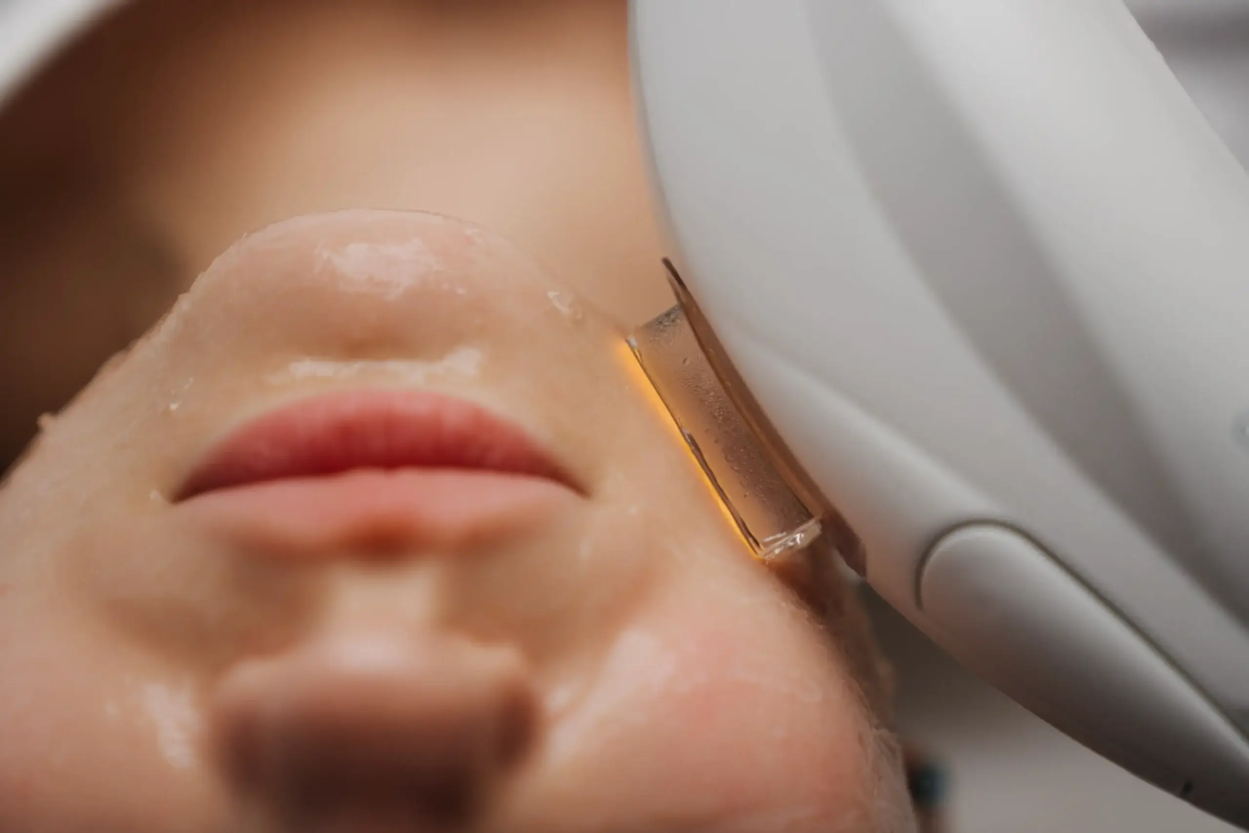 Lumecca IPL: The Ultimate Solution for Skin Tone and Texture Issues