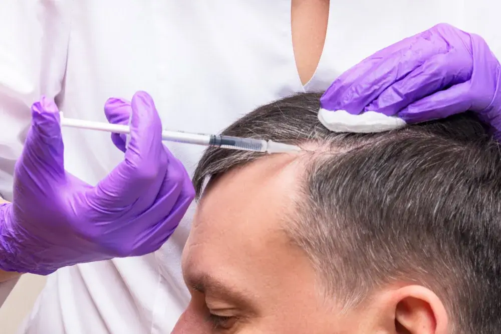 prp hair restoration injection treatment in boca raton, fl